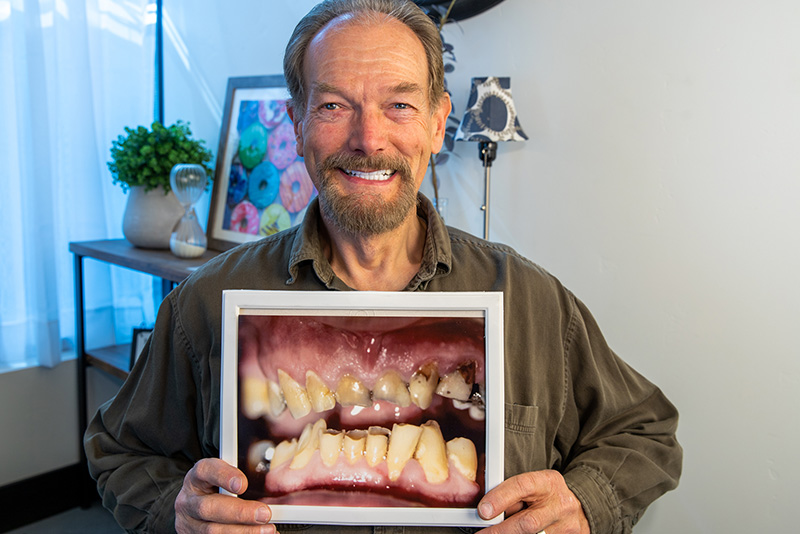 our patient smiling after his full arch dental implant procedure