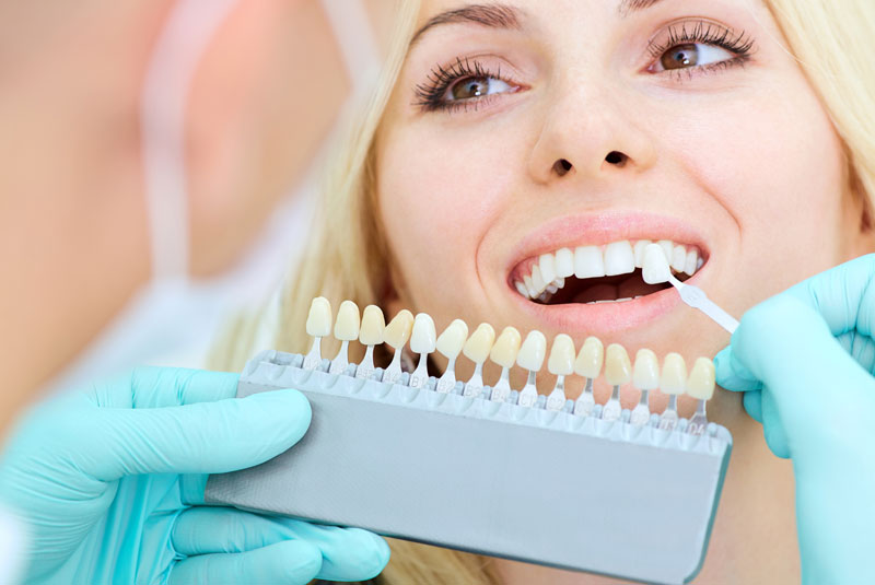 a dentist placing veneers against a patient's smile for color matching