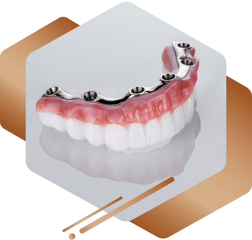 zirconia bridge graphic