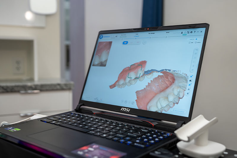 digital scan on modern laptop