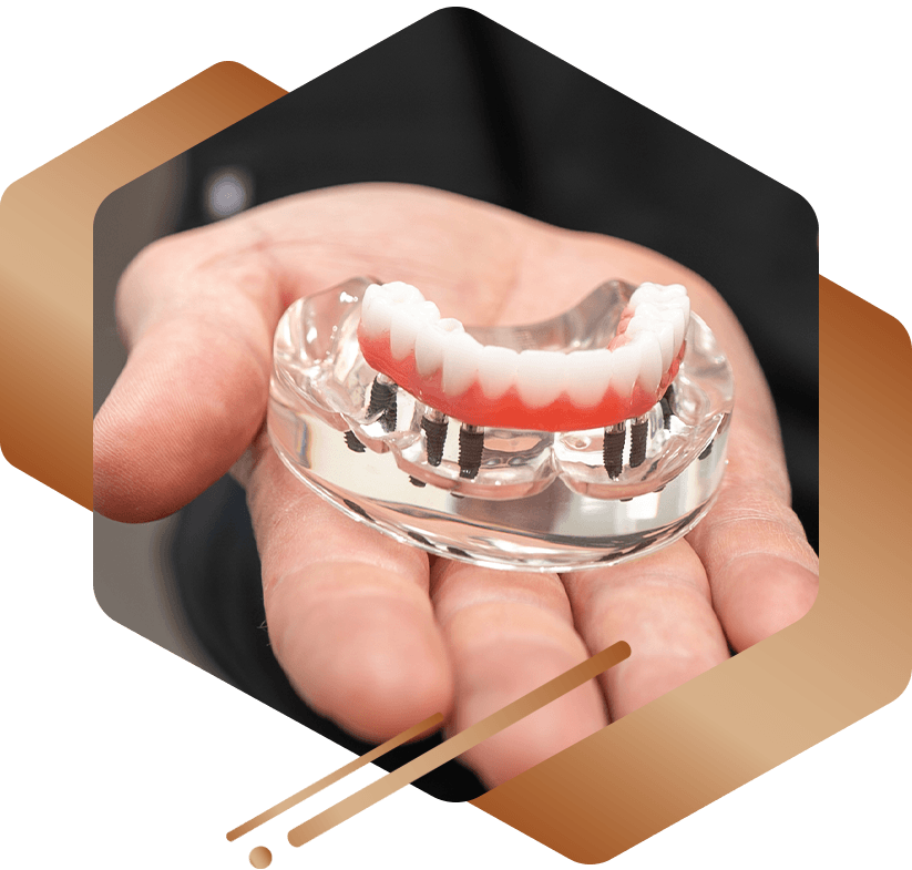 dr holding a full arch